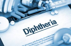 Suspected diphtheria outbreak noticed in King’s College Lagos