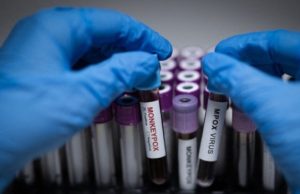 The $430m Deficit: Nigeria’s Race Against Time to Fund Life-Saving Vaccines