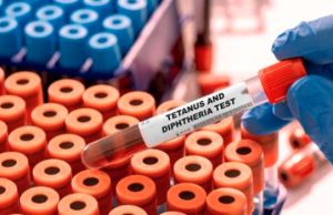 Kano Flags Off Second Round Of Maternal, Neonatal Tetanus Vaccination Campaign Tetanus-and-diphtheria-blood-test