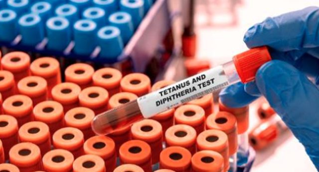 Tetanus-and-diphtheria-blood-test